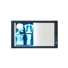 High quality double medical led x ray negatoscope film viwer box from China